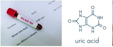 Uric acid supplier in oman