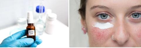 Azelaic acid SUPPLIER IN Oman